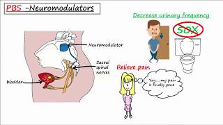 How to GET RID of Bladder Infections  Recurrent UTI [upl. by Araht]