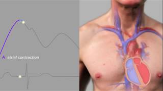 Easy Measurement of Jugular Venous Pressure [upl. by Sellihca]