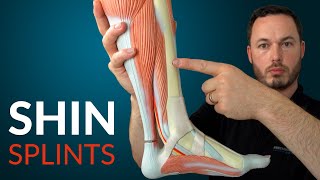 Understanding SHIN SPLINTS and how to fix it [upl. by Giovanni]