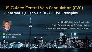 UltrasoundGuided Internal Jugular Vein Cannulation  Principles Part 1 [upl. by Ermey]