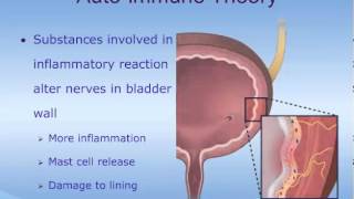 Understanding Interstitial Cystitis IC [upl. by Yatnwahs]