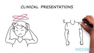 Methemoglobinemia  Signs Symptoms and Treatment Approaches [upl. by Oirasec]