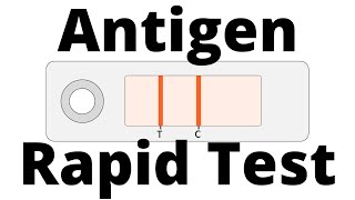 How SARSCoV2 Antigen Rapid Tests work Covid19 Testing [upl. by Aihsei]