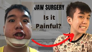 I was bullied into getting jaw surgery 🙁 [upl. by Riley86]