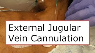 External Jugular Vein Cannulation [upl. by Radcliffe]