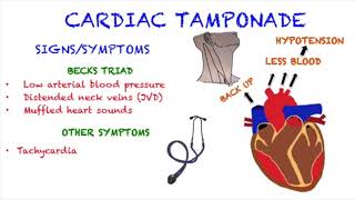 Cardiac Tamponade [upl. by Godding]