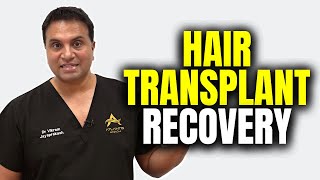 What To Expect After A Hair Transplant [upl. by Shelagh]