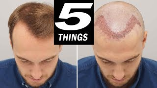 5 THINGS to do after HAIR TRANSPLANT [upl. by Aerbma90]