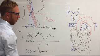 Jugular venous pressure [upl. by Gen]